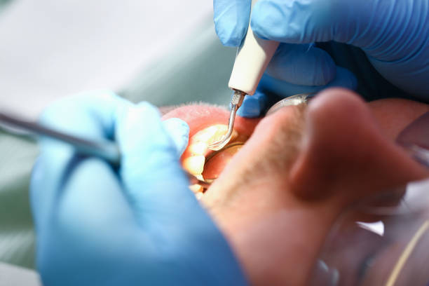 Best Same-Day Emergency Dental Services in Lake Telemark, NJ