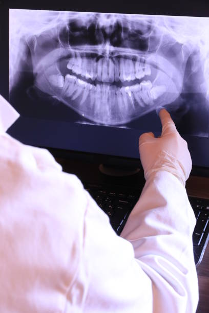Best Emergency Denture Repair in Lake Telemark, NJ