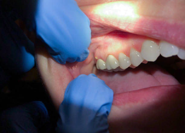 Best Weekend Emergency Dentist in Lake Telemark, NJ