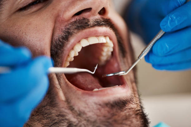 Best Emergency Treatment for Dental Infections or Abscesses in Lake Telemark, NJ