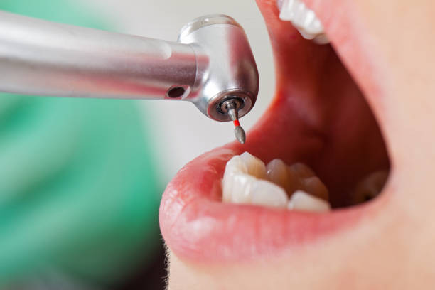 Best After-Hours Dental Trauma Care in Lake Telemark, NJ